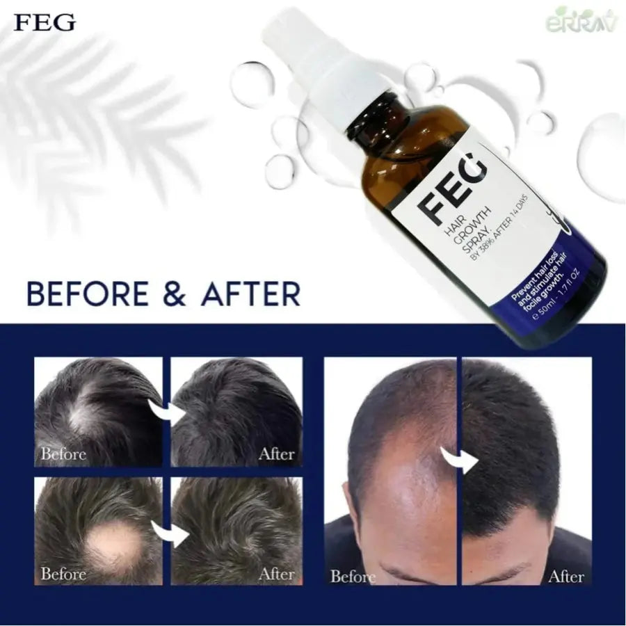 Feg Hair Growth Spray